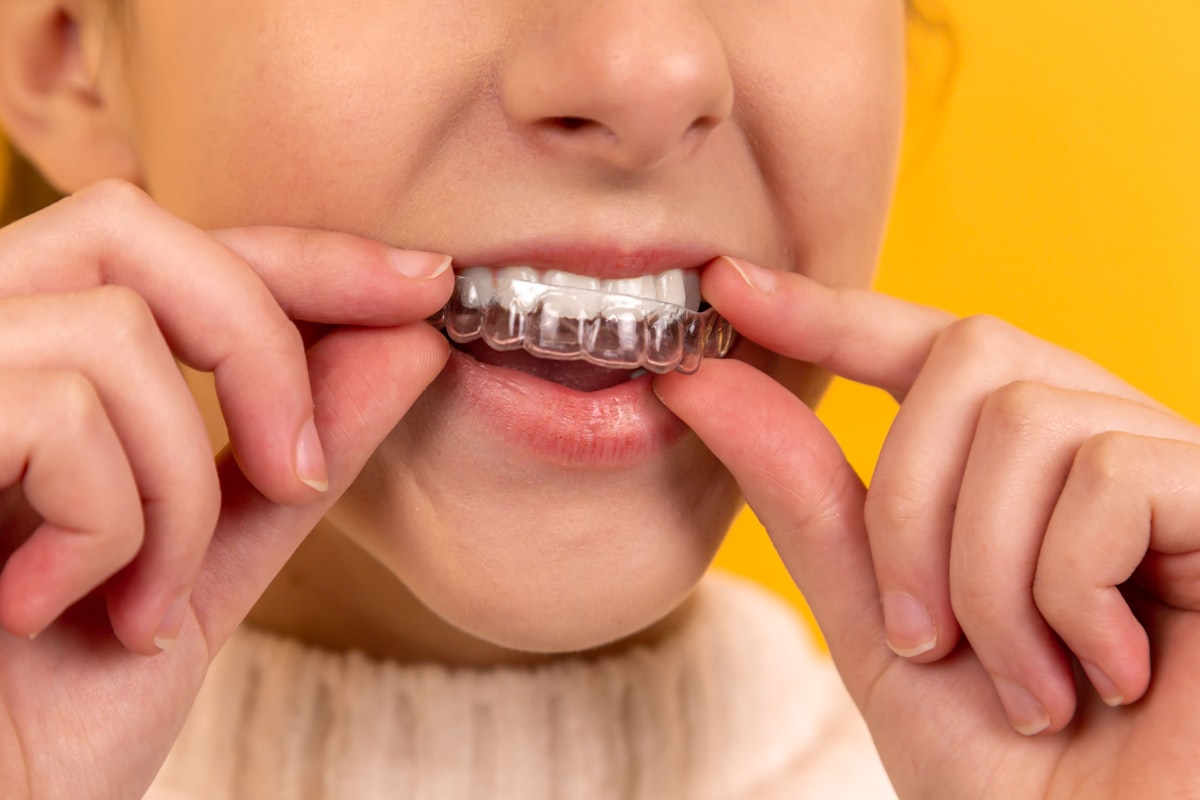 Braces & Clear Aligners